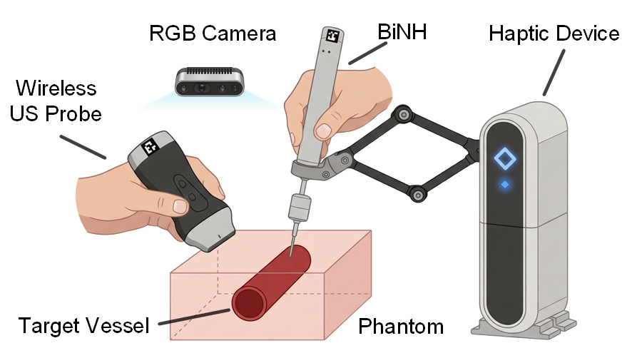 Overview of Bioimpedance-Informed Haptic Needle System with Human-in-the-Loop Control for Central Venous Access